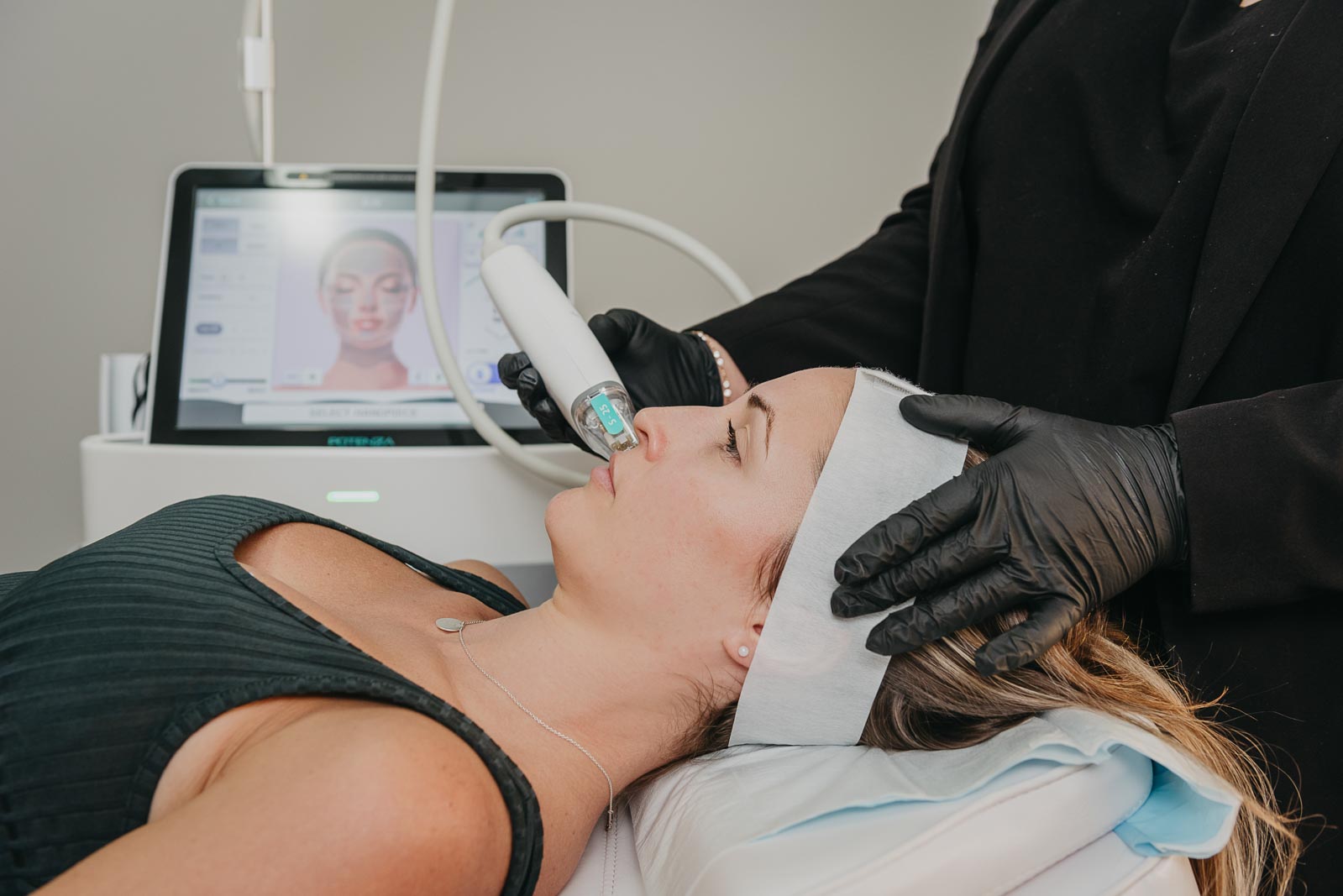 RF Microneedling Treatment